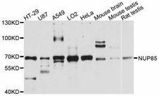 NUP85 / Pericentrin 1 Antibody - Western blot analysis of extracts of various cell lines, using NUP85 antibody at 1:3000 dilution. The secondary antibody used was an HRP Goat Anti-Rabbit IgG (H+L) at 1:10000 dilution. Lysates were loaded 25ug per lane and 3% nonfat dry milk in TBST was used for blocking. An ECL Kit was used for detection and the exposure time was 10s.