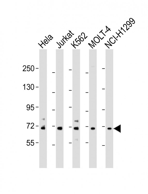 NUP85 / Pericentrin 1 Antibody - All lanes: Anti-NUP85 Antibody (N-Term) at 1:2000 dilution Lane 1: Hela whole cell lysate Lane 2: Jurkat whole cell lysate Lane 3: K562 whole cell lysate Lane 4: MOLT-4 whole cell lysate Lane 5: NCI-H1299 whole cell lysate Lysates/proteins at 20 µg per lane. Secondary Goat Anti-Rabbit IgG, (H+L), Peroxidase conjugated at 1/10000 dilution. Predicted band size: 75 kDa Blocking/Dilution buffer: 5% NFDM/TBST.