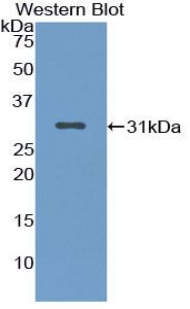 NUP88 Antibody - Western blot of recombinant NUP88.  This image was taken for the unconjugated form of this product. Other forms have not been tested.