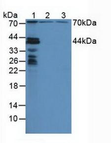 NUP88 Antibody - Western Blot; Sample: Lane1: Mouse Liver Tissue; Lane2: Human Hela Cells; Lane3: Human HepG2 Cells.
