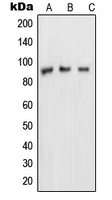 NUP88 Antibody - Western blot analysis of NUP88 expression in MDAMB453 (A); A431 (B); HeLa (C) whole cell lysates.