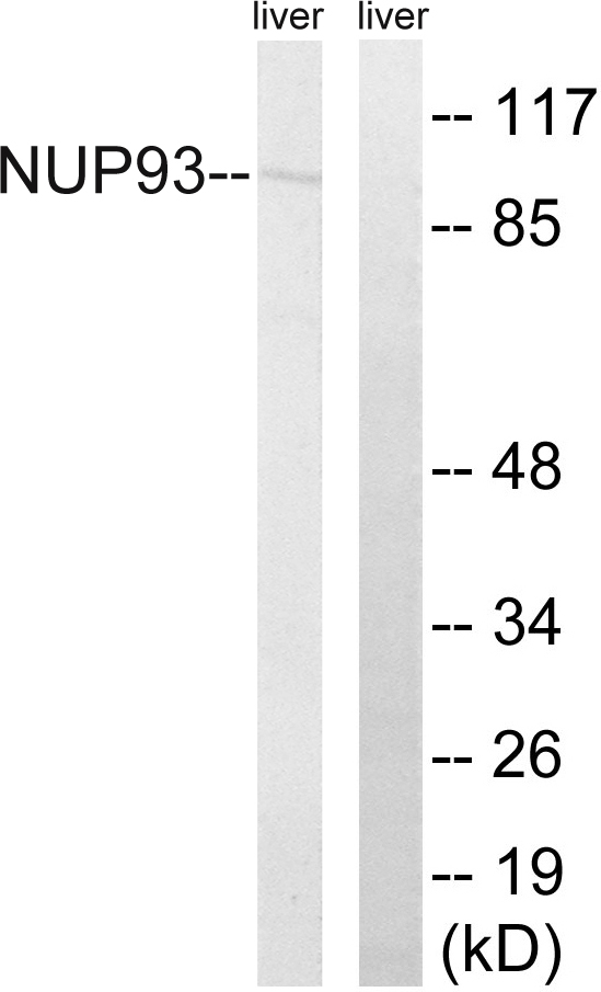 NUP93 Antibody - Western blot analysis of lysates from rat liver cells, using NUP93 Antibody. The lane on the right is blocked with the synthesized peptide.