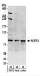 NUP93 Antibody - Detection of Human NUP93 by Western Blot. Samples: Whole cell lysate (50 ug) from 293T, HeLa, and Jurkat cells. Antibodies: Affinity purified rabbit anti-NUP93 antibody used for WB at 1 ug/ml. Detection: Chemiluminescence with an exposure time of 30 seconds.
