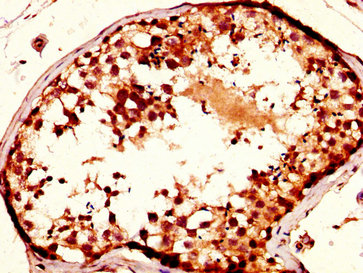 NUP93 Antibody - Immunohistochemistry image at a dilution of 1:400 and staining in paraffin-embedded human testis tissue performed on a Leica BondTM system. After dewaxing and hydration, antigen retrieval was mediated by high pressure in a citrate buffer (pH 6.0) . Section was blocked with 10% normal goat serum 30min at RT. Then primary antibody (1% BSA) was incubated at 4 °C overnight. The primary is detected by a biotinylated secondary antibody and visualized using an HRP conjugated SP system.