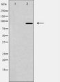 NUP93 Antibody - Western blot analysis of extracts of rat liver cells using NUP93 antibody. The lane on the left is treated with the antigen-specific peptide.