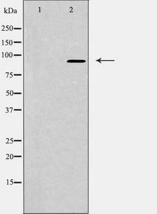 NUP93 Antibody - Western blot analysis of extracts of rat liver cells using NUP93 antibody. The lane on the left is treated with the antigen-specific peptide.