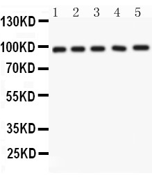 NUP98 Antibody - NUP98 antibody Western blot. All lanes: Anti NUP98 at 0.5 ug/ml. Lane 1: Rat Liver Tissue Lysate at 50 ug. Lane 2: Mouse Liver Tissue Lysate at 50 ug. Lane 3: Mouse Lung Tissue Lysate at 50 ug. Lane 4: A549 Whole Cell Lysate at 40 ug. Lane 5: SMMC Whole Cell Lysate at 40 ug. Predicted band size: 98 kD. Observed band size: 98 kD.