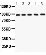 NUP98 Antibody - NUP98 antibody Western blot. All lanes: Anti NUP98 at 0.5 ug/ml. Lane 1: Rat Liver Tissue Lysate at 50 ug. Lane 2: Mouse Liver Tissue Lysate at 50 ug. Lane 3: Mouse Lung Tissue Lysate at 50 ug. Lane 4: A549 Whole Cell Lysate at 40 ug. Lane 5: SMMC Whole Cell Lysate at 40 ug. Predicted band size: 98 kD. Observed band size: 98 kD.