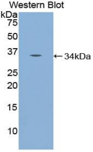 NUP98 Antibody - Western blot of recombinant NUP98.  This image was taken for the unconjugated form of this product. Other forms have not been tested.