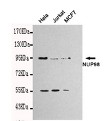 NUP98 Antibody - Western blot detection of NUP98 in Hela.