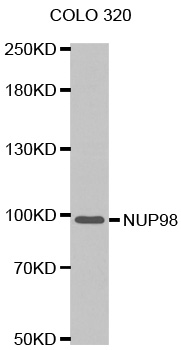 NUP98 Antibody - Western blot analysis of extracts of COLO 320 cells tissue, using NUP98 antibody.
