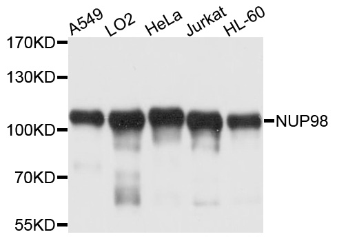 NUP98 Antibody - Western blot analysis of extracts of various cell lines, using NUP98 antibody at 1:1000 dilution. The secondary antibody used was an HRP Goat Anti-Rabbit IgG (H+L) at 1:10000 dilution. Lysates were loaded 25ug per lane and 3% nonfat dry milk in TBST was used for blocking. An ECL Kit was used for detection and the exposure time was 5s.