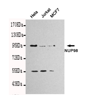 NUP98 Antibody - Western blot detection of NUP98 in HeLa, Jurkat and MCF7 cell lysates using NUP98 mouse monoclonal antibody (1:1000 dilution). Predicted band size: 98kDa. Observed band size: 98kDa.