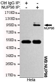 NUP98 Antibody - Immunoprecipitation analysis of HeLa cell lysates using NUP98 mouse monoclonal antibody.