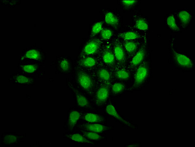 NUP98 Antibody - Immunofluorescence staining of A549 cells at a dilution of 1:100, counter-stained with DAPI. The cells were fixed in 4% formaldehyde, permeabilized using 0.2% Triton X-100 and blocked in 10% normal Goat Serum. The cells were then incubated with the antibody overnight at 4 °C.The secondary antibody was Alexa Fluor 488-congugated AffiniPure Goat Anti-Rabbit IgG (H+L) .