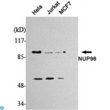 NUP98 Antibody - Western Blot (WB) analysis using Nup98 Monoclonal Antibody against HeLa, Jurkat, MCF7 cell lysate.