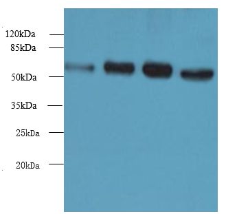 NUPL1 Antibody - Western blot. All lanes: NUPL1 antibody at 4 ug/ml. Lane 1: HepG-2 whole cell lysate. Lane 2: HeLa whole cell lysate. Lane 3: LO2 whole cell lysate. Lane 4: Mouse thymus tissue. Secondary Goat polyclonal to Rabbit IgG at 1:10000 dilution. Predicted band size: 61 kDa. Observed band size: 61 kDa.