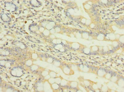 NUPL1 Antibody - Immunohistochemistry of paraffin-embedded human small intestine tissue using NUP58 Antibody at dilution of 1:100