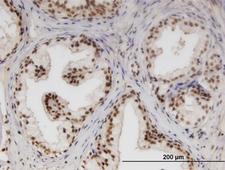 NUPL1 Antibody - Immunoperoxidase of monoclonal antibody to NUPL1 on formalin-fixed paraffin-embedded human prostate. [antibody concentration 3 ug/ml]