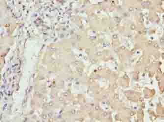 NUPL2 Antibody - Immunohistochemistry of paraffin-embedded human liver tissue using antibody at dilution of 1:100.