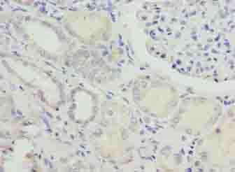 NUPL2 Antibody - Immunohistochemistry of paraffin-embedded human kidney tissue using antibody at dilution of 1:100.
