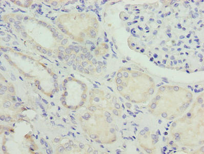 NUPL2 Antibody - Immunohistochemistry of paraffin-embedded human kidney tissue using NUPL2 Antibody at dilution of 1:100