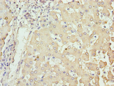 NUPL2 Antibody - Immunohistochemistry of paraffin-embedded human liver tissue using NUPL2 Antibody at dilution of 1:100
