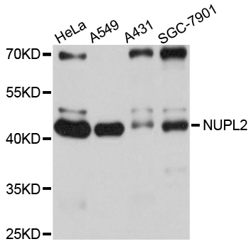 NUPL2 Antibody - Western blot analysis of extracts of various cell lines, using NUPL2 antibody at 1:1000 dilution. The secondary antibody used was an HRP Goat Anti-Rabbit IgG (H+L) at 1:10000 dilution. Lysates were loaded 25ug per lane and 3% nonfat dry milk in TBST was used for blocking. An ECL Kit was used for detection and the exposure time was 15s.