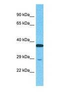 NUPL2 Antibody - Western blot of NUPL2 Antibody with human HCT15 Whole Cell lysate.  This image was taken for the unconjugated form of this product. Other forms have not been tested.