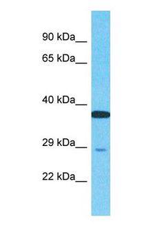 NUPL2 Antibody - Western blot of NUPL2 Antibody with human HCT15 Whole Cell lysate.  This image was taken for the unconjugated form of this product. Other forms have not been tested.