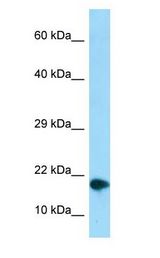 NUPR1 Antibody - NUPR1 antibody Western Blot of 293T.  This image was taken for the unconjugated form of this product. Other forms have not been tested.