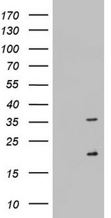 NUS1 Antibody - HEK293T cells were transfected with the pCMV6-ENTRY control (Left lane) or pCMV6-ENTRY NUS1 (Right lane) cDNA for 48 hrs and lysed. Equivalent amounts of cell lysates (5 ug per lane) were separated by SDS-PAGE and immunoblotted with anti-NUS1.