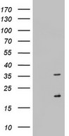 NUS1 Antibody - HEK293T cells were transfected with the pCMV6-ENTRY control (Left lane) or pCMV6-ENTRY NUS1 (Right lane) cDNA for 48 hrs and lysed. Equivalent amounts of cell lysates (5 ug per lane) were separated by SDS-PAGE and immunoblotted with anti-NUS1.