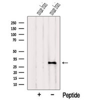 NUS1 Antibody - Western blot analysis of extracts of mouse brain tissue using NUS1 antibody. The lane on the left was treated with blocking peptide.