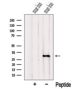 NUS1 Antibody - Western blot analysis of extracts of mouse brain tissue using NUS1 antibody. The lane on the left was treated with blocking peptide.