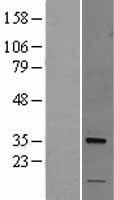 NUS1 Protein - Western validation with an anti-DDK antibody * L: Control HEK293 lysate R: Over-expression lysate