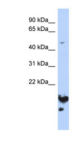 NUSAP1 / NUSAP Antibody - NUSAP1 antibody Western blot of HepG2 cell lysate. This image was taken for the unconjugated form of this product. Other forms have not been tested.