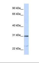 NUSAP1 / NUSAP Antibody - Jurkat cell lysate. Antibody concentration: 1.0 ug/ml. Gel concentration: 12%.  This image was taken for the unconjugated form of this product. Other forms have not been tested.