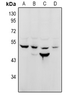 NUSAP1 / NUSAP Antibody - Western blot analysis of NuSAP expression in CT26 (A), PC12 (B), HCT116 (C), PC3 (D) whole cell lysates.