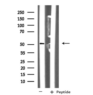 NUSAP1 / NUSAP Antibody - Western blot analysis of extracts of HT29 cells using NUSAP1 antibody.