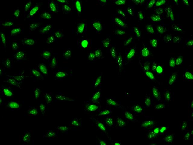 NUSAP1 / NUSAP Antibody - Immunofluorescence staining of NUSAP1 in U2OS cells. Cells were fixed with 4% PFA, permeabilzed with 0.1% Triton X-100 in PBS, blocked with 10% serum, and incubated with rabbit anti-Human NUSAP1 polyclonal antibody (dilution ratio 1:200) at 4°C overnight. Then cells were stained with the Alexa Fluor 488-conjugated Goat Anti-rabbit IgG secondary antibody (green). Positive staining was localized to Nucleus.