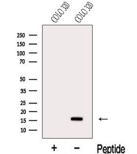 NUT2 / MED10 Antibody - Western blot analysis of extracts of COLO 320 cells using MED10 antibody. The lane on the left was treated with blocking peptide.