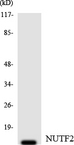 NUTF2 / PP15 Antibody - Western blot analysis of the lysates from HT-29 cells using NUTF2 antibody.