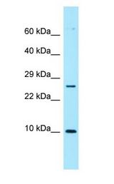 NUTF2 / PP15 Antibody - NUTF2 / PP15 antibody Western Blot of ACHN.  This image was taken for the unconjugated form of this product. Other forms have not been tested.