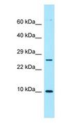 NUTF2 / PP15 Antibody - NUTF2 / PP15 antibody Western Blot of ACHN.  This image was taken for the unconjugated form of this product. Other forms have not been tested.