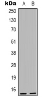 NUTF2 / PP15 Antibody - Western blot analysis of PP15 expression in K562 (A); HeLa (B) whole cell lysates.