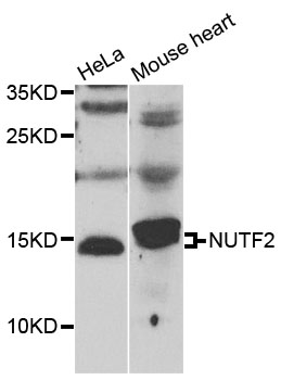 NUTF2 / PP15 Antibody - Western blot analysis of extracts of various cell lines.