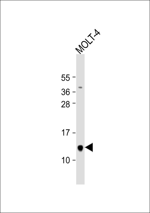 NUTF2 / PP15 Antibody - Anti-PP15 Antibody at 1:1000 dilution + MOLT-4 whole cell lysate Lysates/proteins at 20 ug per lane. Secondary Goat Anti-Rabbit IgG, (H+L), Peroxidase conjugated at 1:10000 dilution. Predicted band size: 14 kDa. Blocking/Dilution buffer: 5% NFDM/TBST.