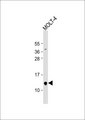 NUTF2 / PP15 Antibody - Anti-PP15 Antibody at 1:1000 dilution + MOLT-4 whole cell lysate Lysates/proteins at 20 ug per lane. Secondary Goat Anti-Rabbit IgG, (H+L), Peroxidase conjugated at 1:10000 dilution. Predicted band size: 14 kDa. Blocking/Dilution buffer: 5% NFDM/TBST.