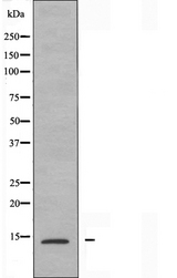 NUTF2 / PP15 Antibody - Western blot analysis of extracts of HeLa cells using NUTF2 antibody.